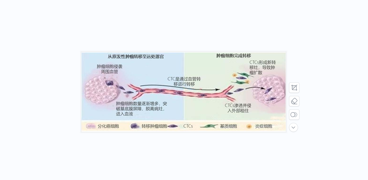 循環(huán)腫瘤細(xì)胞（CTC）簡(jiǎn)讀